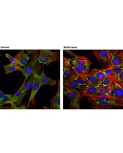 Cell Signaling Fmrp (D14f4) Rabbit mAb