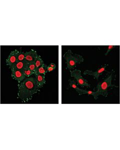 Cell Signaling Fak (D5o7u) Xp Rabbit mAb