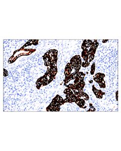 Cell Signaling Keratin 5 (E2t4b) Xp Rabbit mAb (Ihc Preferred)