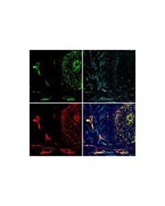 Cell Signaling Col1a1 (E8f4l) Xp Rabbit mAb