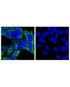 Cell Signaling Cd57 (Hnk-1) Mouse mAb