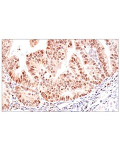 Cell Signaling ADAR1 p150 Isoform (E6U1U) Rabbit mAb