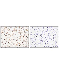 Cell Signaling Cxcr5 (D6l3c) Rabbit mAb (Ihc Specific)