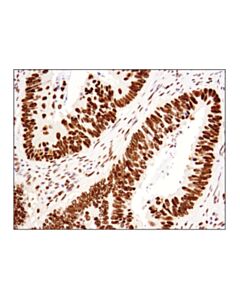 Cell Signaling Brg1 (E8v5b) Mouse mAb