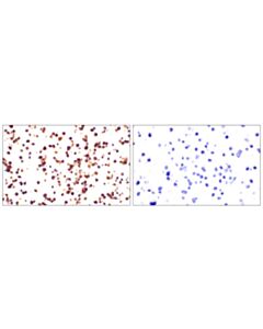 Cell Signaling Integrin Beta2 (E9o7w) Rabbit mAb