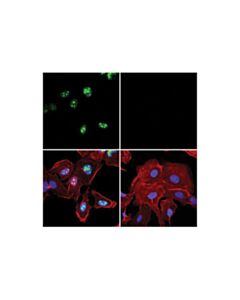 Cell Signaling P14 Arf (E3x6d) Rabbit mAb (Alexa Fluor 488 Conjugate)