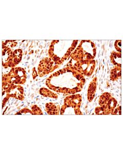 Cell Signaling Taz (E9j5a) Xp Rabbit mAb