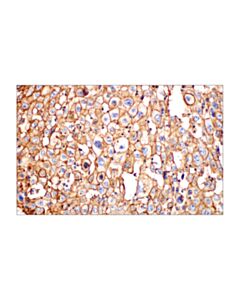Cell Signaling Glut1 (E4s6i) Rabbit mAb