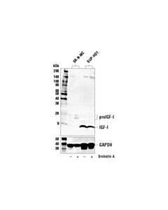 Cell Signaling Igf-I (E6b7o) Rabbit mAb