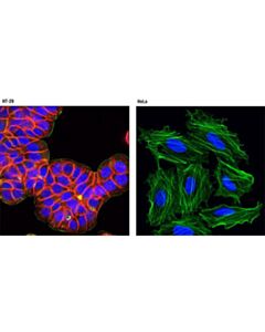 Cell Signaling Epcam (Vu1d9) Mouse mAb (Alexa Fluor<LT/>Sup&Gt;®<LT/>/Sup&Gt; 594 Conjugate)