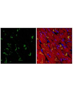 Cell Signaling Desmoplakin (F3J8Y) Rabbit mAb 100 µl