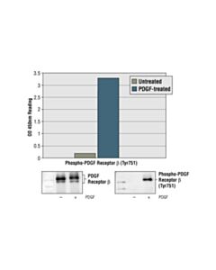 Cell Signaling Pathscan® Phospho-Pdgf Receptor Beta (Tyr751) Sandwich ELISA Kit