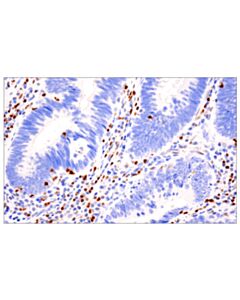 Cell Signaling Tox/Tox2 (E6i3q) Rabbit mAb