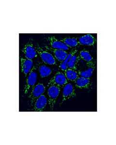Cell Signaling Slp-2 (D5n4e) Rabbit mAb