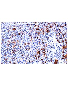 Cell Signaling Cathepsin D (E5V4H) Rabbit mAb 20 uL