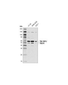 Cell Signaling TBL1XR1/TBLR1 (D4J9C) Rabbit mAb 20 uL