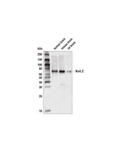 Cell Signaling Kv4.2 (D3e7g) Rabbit mAb