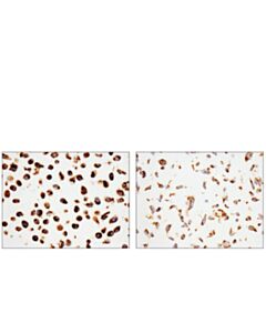 Cell Signaling Mitochondrial Dynamics Antibody Sampler Kit Ii