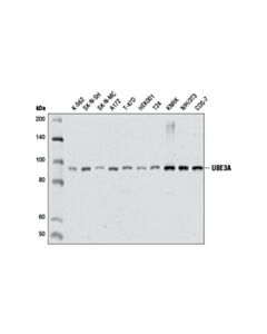 Cell Signaling Ube3a (D10d3) Rabbit mAb