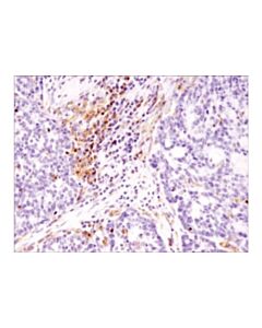Cell Signaling Prex1 (D8d2k) Rabbit mAb (Ihc Specific)