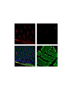 Cell Signaling Alpha-Smooth Muscle Actin (D4k9n) Xp Rabbit mAb (Alexa Fluor 647 Conjugate)