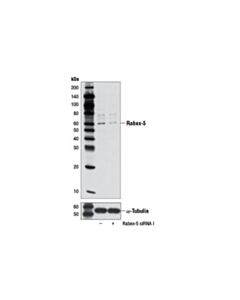 Cell Signaling Rabex-5 (D21f12) Rabbit mAb