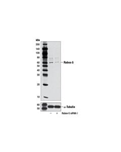 Cell Signaling Rabex-5 (D21F12) Rabbit mAb 20 uL