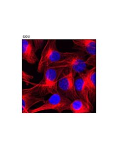 Cell Signaling Beta-Tubulin (9f3) Rabbit mAb (Alexa Fluor 594 Conjugate)