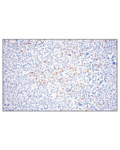 Cell Signaling Phospho-Slp-76 (Ser376) (E3g9u) Xp Rabbit mAb