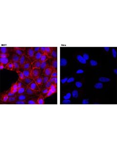 Cell Signaling E-Cadherin (24e10) Rabbit mAb (Alexa Fluor 594 Conjugate)