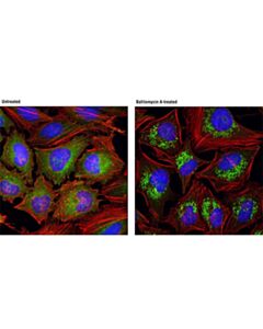 Cell Signaling SQSTM1/p62 (D10E10) Rabbit mAb 20 uL