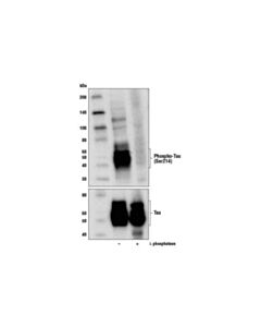 Cell Signaling Phospho-Tau (Ser214) (D1q2x) Rabbit mAb