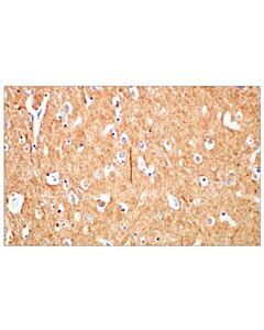 Cell Signaling Beta3-Tubulin (E9f3e) Mouse mAb (BSA And Azide Free)