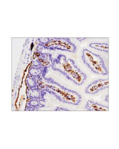 Cell Signaling Cd31 (Pecam-1) (D8v9e) Xp Rabbit mAb