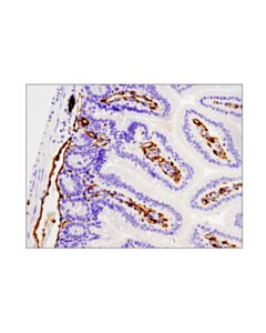 Cell Signaling Cd31 (Pecam-1) (D8v9e) Xp Rabbit mAb