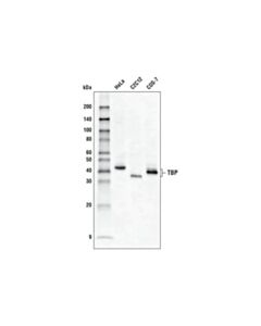 Cell Signaling Tbp (D5c9h) Xp® Rabbit mAb (Hrp Conjugate)