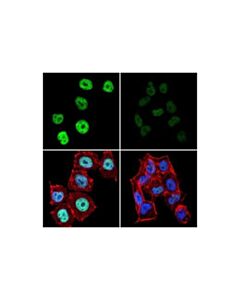 Cell Signaling Mef2d (E6h7n) Rabbit mAb