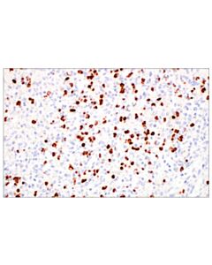 Cell Signaling Mmp-8 (E1c4l) Rabbit mAb