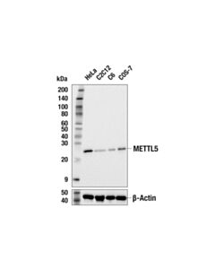 Cell Signaling METTL5 (F4E9V) Rabbit mAb 100 µl