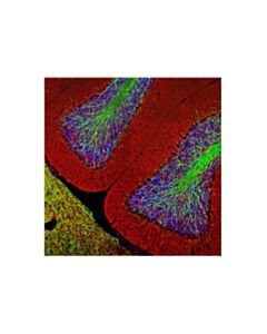 Cell Signaling Myelin Basic Protein (D8x4q) Xp Rabbit mAb