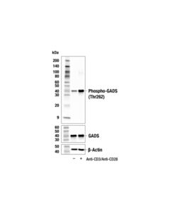 Cell Signaling Phospho-Gads (Thr262) (E8l3b) Rabbit mAb
