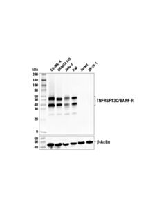 Cell Signaling Tnfrsf13c/Baff-R (E3c1q) Rabbit mAb (BSA And Azide Free)
