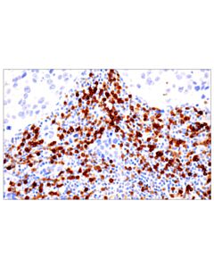 Cell Signaling Trbc1/Tcrbeta Constant Region 1 (E6z3s) Rabbit mAb
