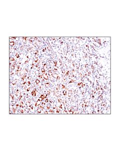 Cell Signaling Bcat2 (D8k3o) Rabbit mAb