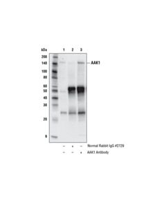 Cell Signaling Aak1 Antibody