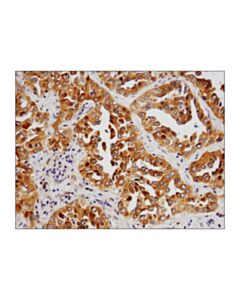 Cell Signaling Prmt5 (D5p2t) Rabbit mAb