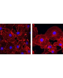 Cell Signaling Beta-Actin (13e5) Rabbit mAb (Alexa Fluor 555 Conjugate)