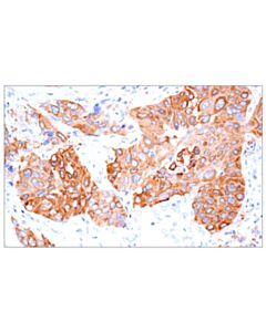 Cell Signaling Map1b (E8s8r) Rabbit mAb (If Formulated)