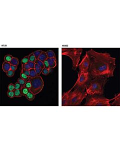 Cell Signaling Cdt1 (D10f11) Rabbit mAb