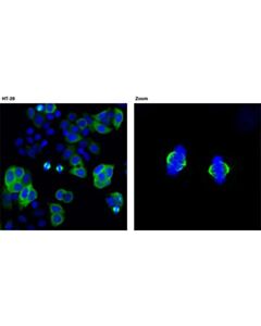 Cell Signaling Tacc3 (D9e4) Xp Rabbit mAb